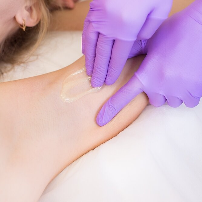 Процедура шугаринга